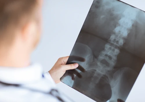 Chiropractic Mt. Greenwood IL Root Cause of Back Pain